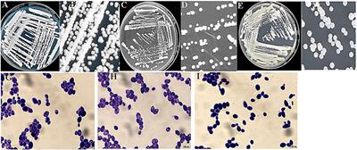 Screening and oenological property analysis of ethanol-tolerant non-Saccharomyces yeasts isolated from Rosa roxburghii Tratt